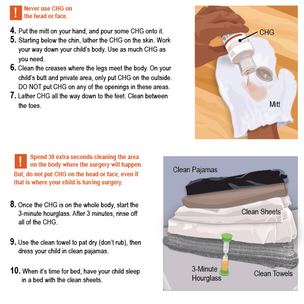 4. Put the mitt on your hand, and pour some CHG onto it.  5. Starting below the chin, lather the CHG on the skin. 		    Work your way down your child’s body. Use as much      	    CHG as you need.  6. Clean the creases where the legs meet the body. On 	   	    your child’s butt and private area, only put CHG on the    	    outside. DO NOT put CHG on any of the openings in 	  	    these areas.  7. Lather CHG all the way down to the feet. Clean 	 	    between the toes. 8. Once the CHG is on the whole body, start the 3-minute hourglass. After 3 minutes, rinse off all of the CHG.  9. Use the clean towel to pat dry (don’t rub), then dress your child in clean pajamas.  10. When it’s time for bed, have your child sleep in a bed with the clean sheets.