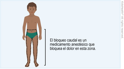 Illustration: caudal block